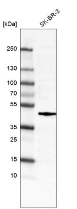 c-Fos Antibody (CL6381), Novus Biologicals 25 &mu;L; c-Fos Antibody; Unconjugated:Antibodies,